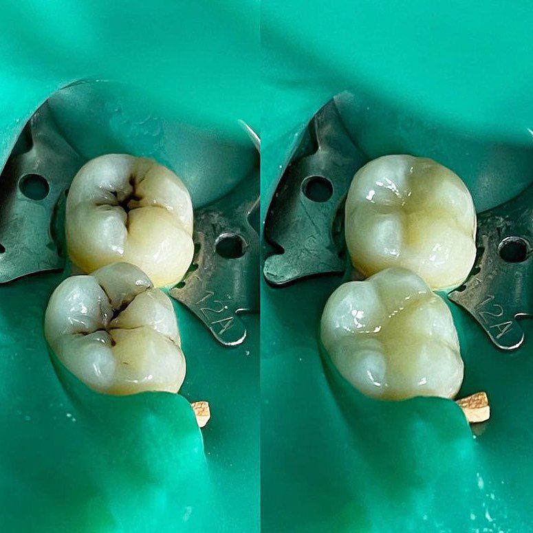 Case 6