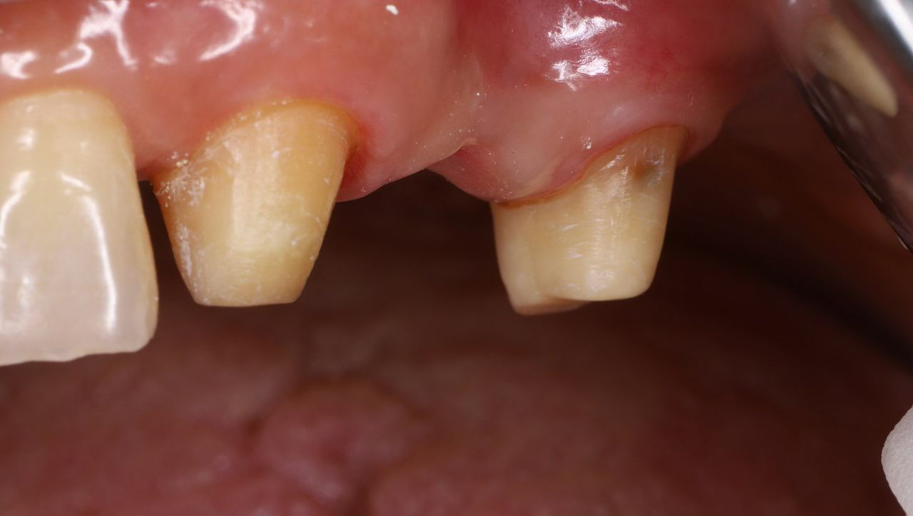 Case 8
