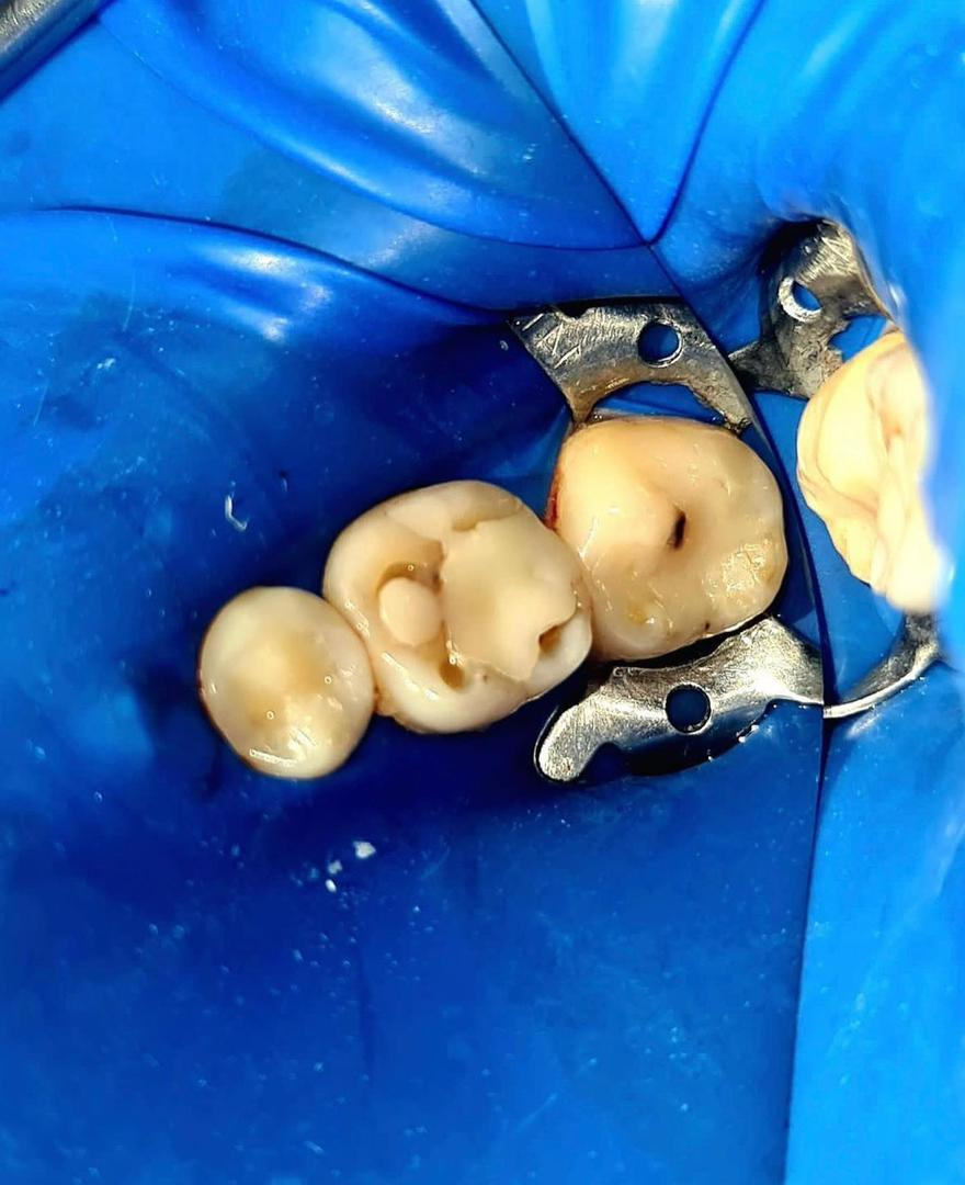 Case 10