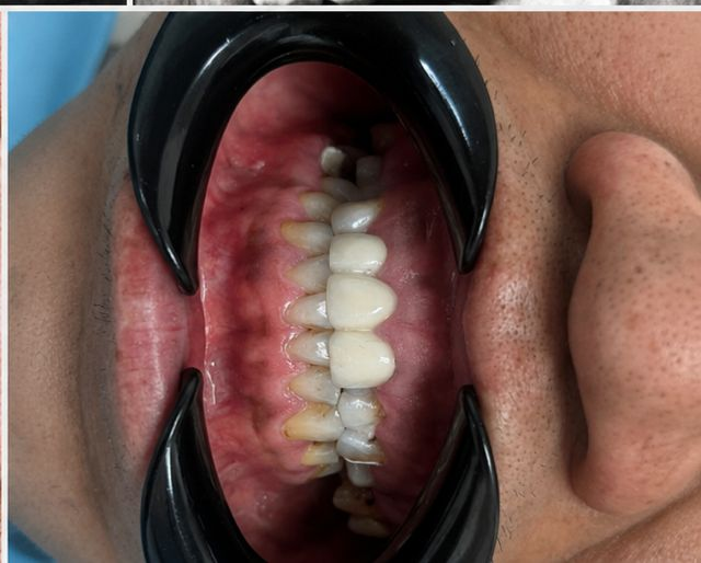 Case 4